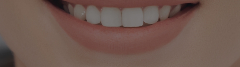 審美治療・ホワイトニング